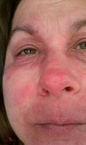 whymyallergy.com